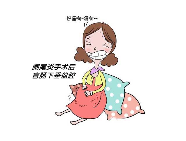 异病同治效果妙，阑尾炎手术后盲肠下垂盆腔患者痊愈