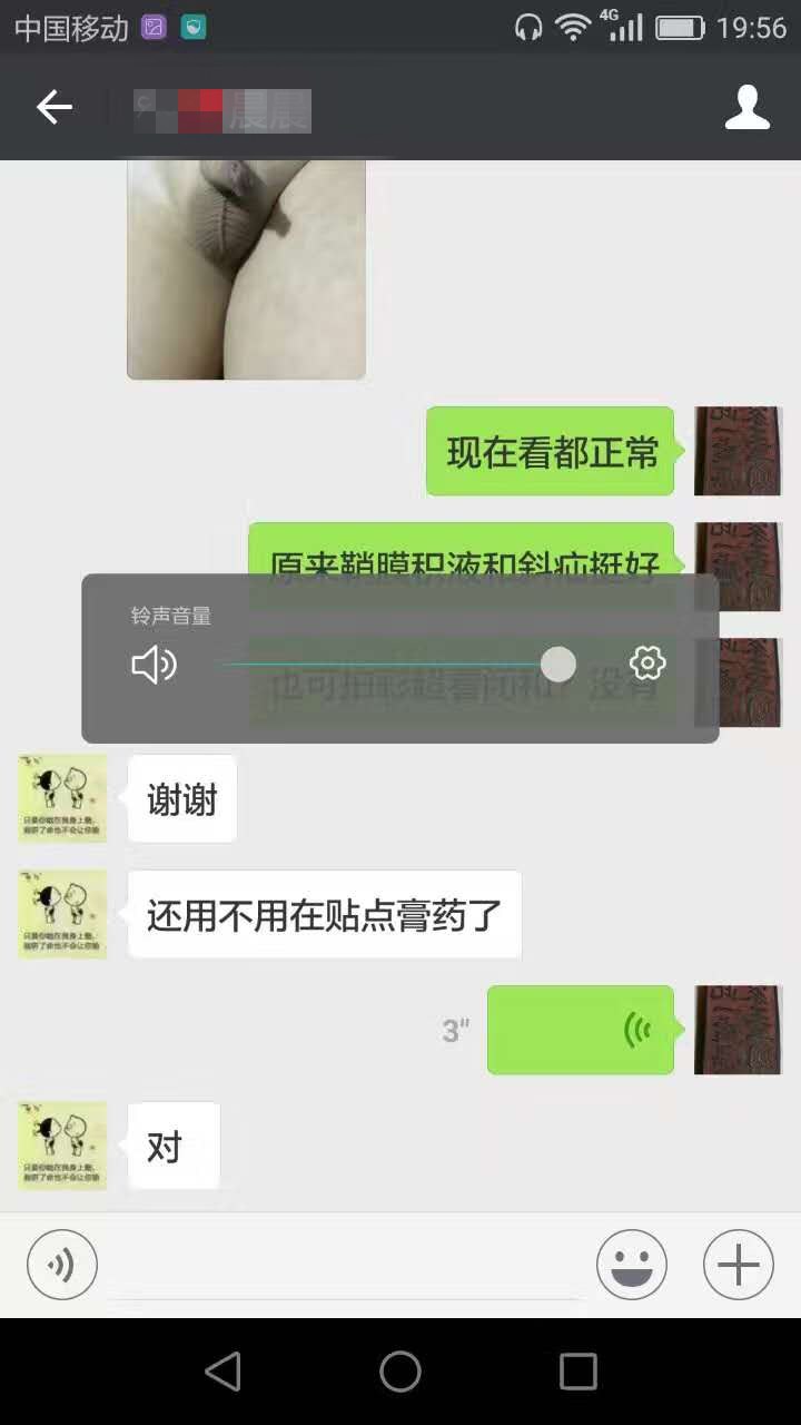 鞘膜积液、腹股沟斜疝、疝气